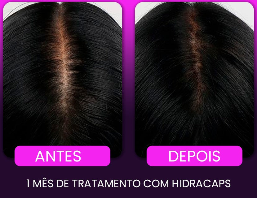 1 Tônico capilar