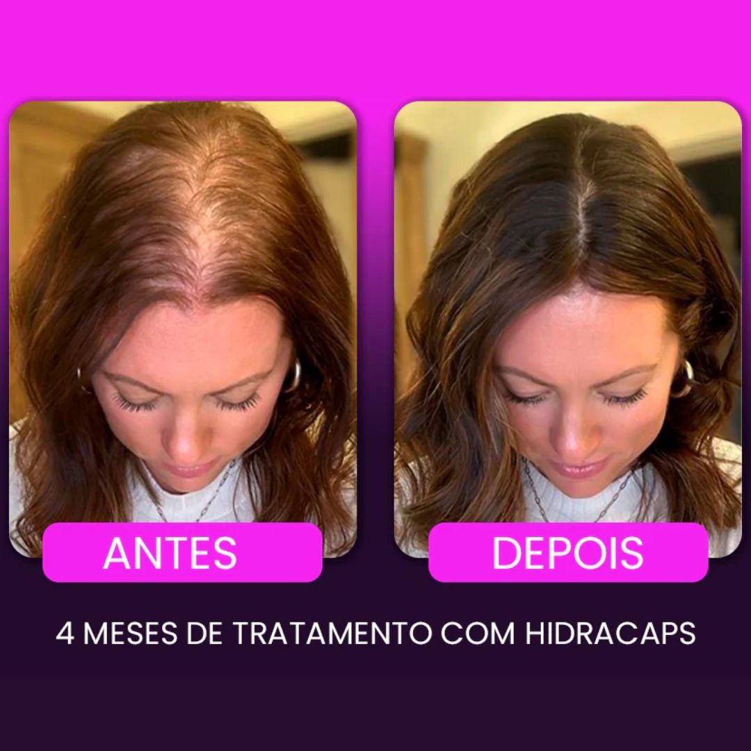 Kit 1 HidraCaps + 1 Tônico